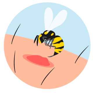 Illustration "Wespenstich"